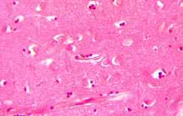 Мозги под микроскопом