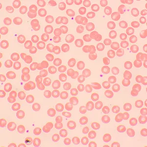 Микроскоп биологический цифровой MAGUS Bio D250TL, изображение 26